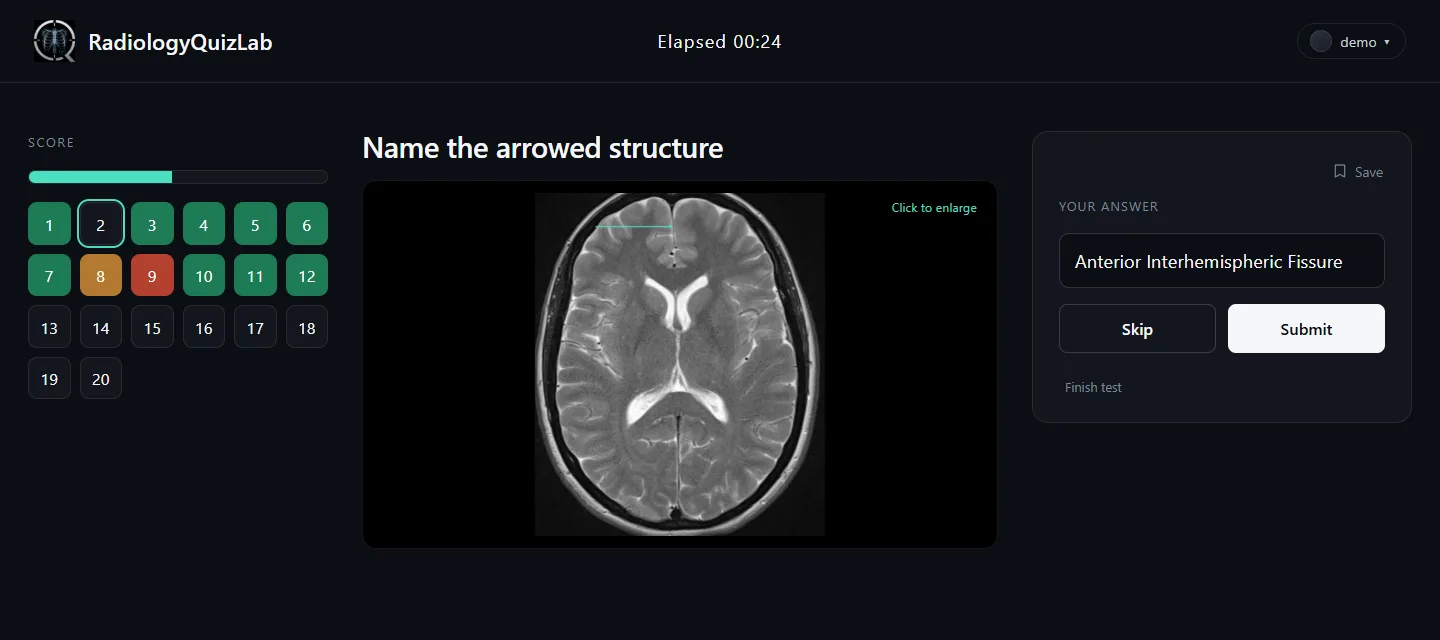 The same question with an answer typed into the box.